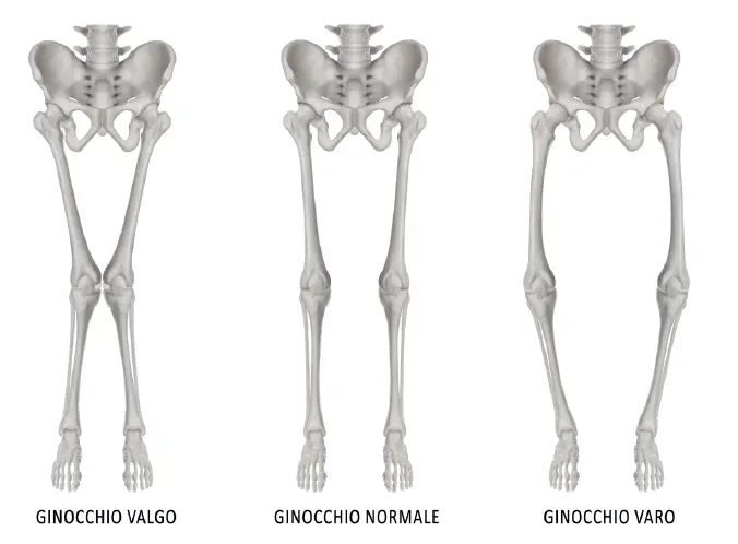 Articolazione del ginocchio