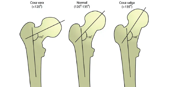 Articolazioni dell’arto inferiore